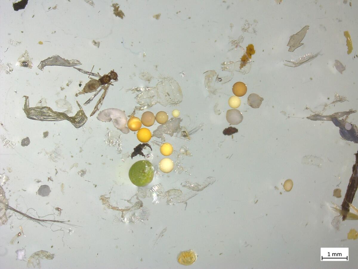 Microplastic under the Microscope. © Greenpeace