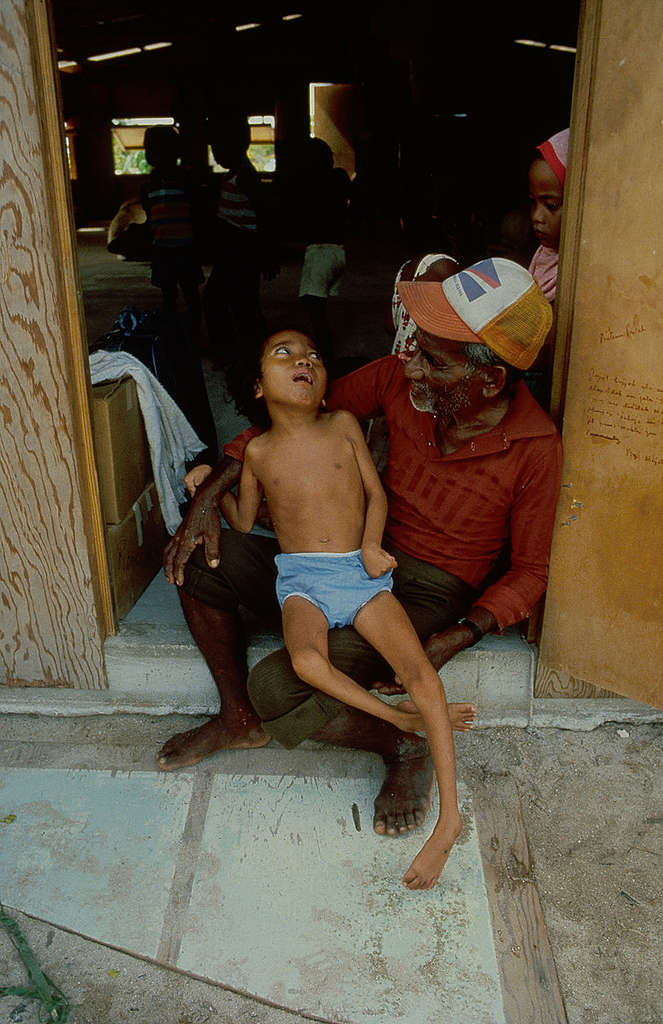 Girl with Birth Defects in Rongelap. © Greenpeace / Fernando Pereira