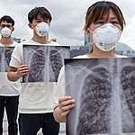 醫學研究顯示，持續吸入污染的空氣會帶來高血壓、糖尿病、心血管疾病和慢性肺病等疾病，甚至增加新冠肺炎的重症和死亡的風險。