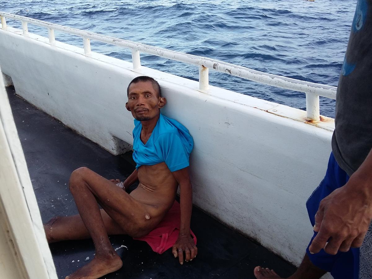 根據宜蘭縣漁工職業工會（Yilan Migrant Fishermen Union）提供的證據，發現原本身體健康的印尼漁工Supriyantoy，在臺灣漁船工作僅4個月就變得骨瘦如柴。